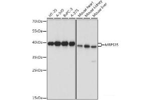 Western blot analysis of extracts of various cell lines using MRPS35 Polyclonal Antibody at dilution of 1:1000. (MRPS35 anticorps)