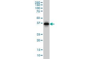 RP2 monoclonal antibody (M02), clone 5C10 Western Blot analysis of RP2 expression in Hela S3 NE .