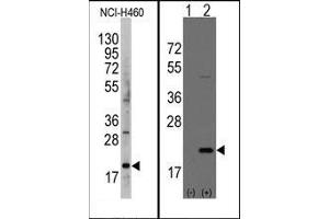 Image no. 1 for anti-Anterior Gradient Homolog 2 (Xenopus Laevis) (AGR2) (AA 102-132) antibody (ABIN358784) (AGR2 anticorps  (AA 102-132))