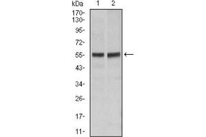 Western blot analysis using FAS antibody against Hela (1), Jurkat (2) cell lysate. (FAS anticorps)