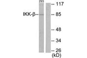 Western blot analysis of extracts from 293 cells, treated with LPS 100ng/ml 30', using IKK-beta (Ab-188) Antibody. (IKBKB anticorps  (AA 161-210))