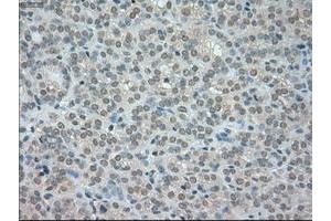 Image no. 5 for anti-Neurotrophic tyrosine Kinase, Receptor, Type 3 (NTRK3) antibody (ABIN1499842)