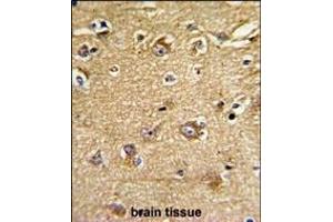 Formalin-fixed and paraffin-embedded human brain tissue reacted with IT Antibody (Center), which was peroxidase-conjugated to the secondary antibody, followed by DAB staining.