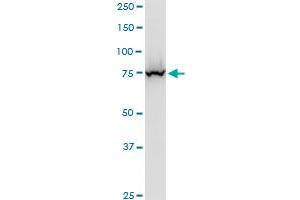 EPC1 polyclonal antibody (A01), Lot # ABNOVA060706QCS1.