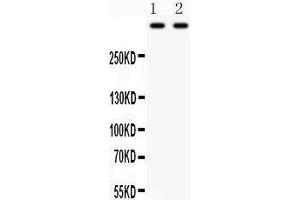 Western Blotting (WB) image for anti-Plectin (PLEC) (AA 2644-2671), (Middle Region) antibody (ABIN3043900)