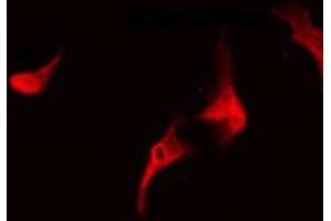 anti-Neuroblastoma Breakpoint Family, Member 7 (NBPF7) (C-Term) antibody