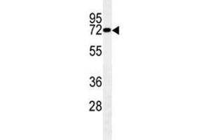 LIMK1 antibody western blot analysis in mouse brain tissue lysate.
