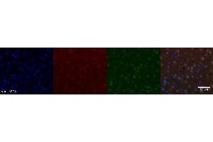 Immunohistochemistry (IHC) image for anti-Nuclear Receptor Subfamily 4, Group A, Member 2 (NR4A2) antibody (ABIN7456241)