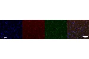 Immunohistochemistry (IHC) image for anti-Nuclear Receptor Subfamily 4, Group A, Member 2 (NR4A2) antibody (ABIN7456241) (NR4A2 anticorps)