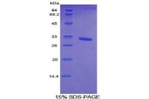 SDS-PAGE analysis of Mouse Cytochrome P450 26A1 Protein. (CYP26A1 Protéine)