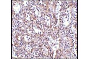 Immunohistochemistry of STIM1 in human spleen tissue with this product at 2.