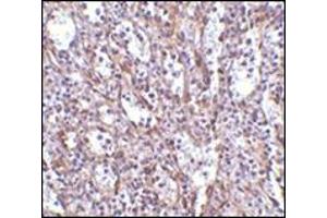 Immunohistochemistry of STIM1 in human spleen tissue with this product at 2.