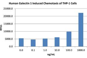 SDS-PAGE of Human Galectin-1 Recombinant Protein Bioactivity of Human Galectin-1 Recombinant Protein.