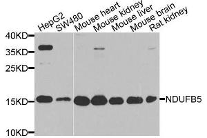Western blot analysis of extracts of various cell lines, using NDUFB5 antibody. (NDUFB5 anticorps  (AA 100-189))