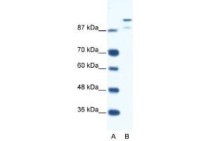 HKR1 antibody (20R-1118) used at 1. (HKR1 anticorps  (N-Term))