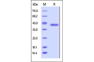 Human Galectin-4, His Tag on  under reducing (R) condition. (GAL4 Protein (AA 1-323) (His tag))