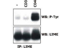 Induction of LIME tyrosine phosphorylation.