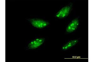 Immunofluorescence of monoclonal antibody to MEOX1 on HeLa cell. (MEOX1 anticorps  (AA 165-252))