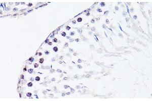 Immunohistochemistry of paraffin-embedded Rat testis using FGF12 Polyclonal Antibody at dilution of 1:150 (40x lens). (FGF12 anticorps)
