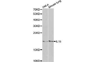 Western blot analysis of extracts of various cell lines, using IL18 antibody. (IL-18 anticorps)