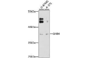 Western blot analysis of extracts of various cell lines, using GNB4 antibody (ABIN6293322) at 1:3000 dilution.