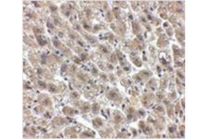 Immunohistochemistry of Albumin in human liver tissue with Albumin antibody at 2. (Albumin anticorps  (Center))