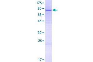 Image no. 1 for IQ Motif Containing G (IQCG) (AA 1-443) protein (GST tag) (ABIN1308037)