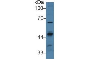 Detection of PPM1A in Human 293T cell lysate using Polyclonal Antibody to Protein Phosphatase, Mg2+/Mn2+ Dependent 1A (PPM1A)