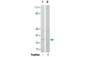 Western blot analysis of extracts from HUVEC cells, using IGFBP3 polyclonal antibody . (IGFBP3 anticorps  (Ser183))