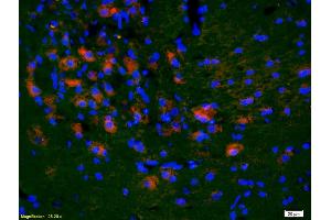 Formalin-fixed and paraffin-embedded rat brain labeled with Anti-KLF5/UKHC Polyclonal Antibody, Unconjugated (ABIN739515) 1:200, overnight at 4°C, The secondary antibody was Goat Anti-Rabbit IgG, Cy3 conjugated used at 1:200 dilution for 40 minutes at 37°C. (KLF5 anticorps  (AA 61-160))