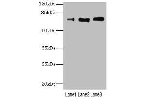 Western blot All lanes: CD180 antibody at 3. (Integrin beta 2 anticorps  (AA 24-220))