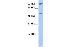WB Suggested Anti-STAT5B Antibody Titration: 1 ug/ml Positive Control: Fetal Brain Lysate (STAT5B anticorps  (C-Term))