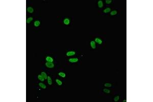 Immunofluorescent analysis of HepG2 cells using ABIN7160958 at dilution of 1:100 and Alexa Fluor 488-congugated AffiniPure Goat Anti-Rabbit IgG(H+L)