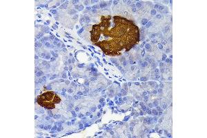 Immunohistochemistry of paraffin-embedded rat pancreatic islet using Secretagogin (Secretagogin (SCGN)) Rabbit mAb (ABIN7270178) at dilution of 1:100 (40x lens).