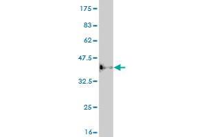 Western Blot detection against Immunogen (36. (ASCL1 anticorps  (AA 137-236))