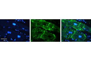 Rabbit Anti-ATP1B1 Antibody   Formalin Fixed Paraffin Embedded Tissue: Human heart Tissue Observed Staining: Plasma membrane in intercalated disk Primary Antibody Concentration: 1:100 Other Working Concentrations: 1:600 Secondary Antibody: Donkey anti-Rabbit-Cy3 Secondary Antibody Concentration: 1:200 Magnification: 20X Exposure Time: 0.