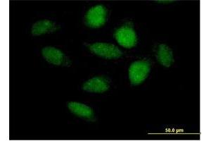 Immunofluorescence of purified MaxPab antibody to APBB3 on HeLa cell.