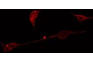 ABIN6275050 staining A549 cells by IF/ICC. (AGBL4 anticorps  (C-Term))