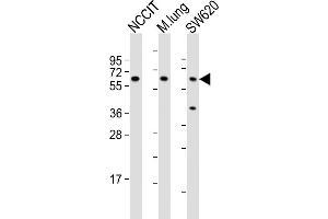 All lanes : Anti-TGFBR2 Antibody (N-term) at 1:2000 dilution Lane 1: NCCIT whole cell lysates Lane 2: mouse lung lysates Lane 3: S whole cell lysates Lysates/proteins at 20 μg per lane. (TGFBR2 anticorps  (N-Term))