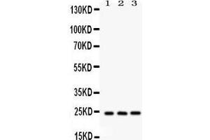 Western Blotting (WB) image for anti-BCL2-Associated Athanogene 2 (BAG2) (AA 1-211) antibody (ABIN3043508)