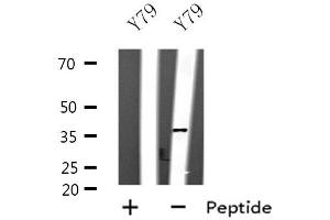 Western blot analysis of extracts of Y79 cell lines, using SPARC antibody. (SPARC anticorps  (Internal Region))