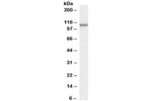 Western blot testing of human pancreas lysate with SMEK1 antibody at 0. (SMEK1 anticorps)