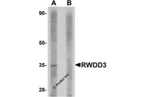 Western Blotting (WB) image for anti-RWD Domain Containing 3 (RWDD3) (C-Term) antibody (ABIN1030633)