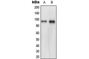 Western blot analysis of NVL expression in HeLa (A), THP1 (B) whole cell lysates. (NVL anticorps  (Center))