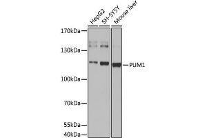 Western blot analysis of extracts of various cell lines, using pum1 antibody (ABIN6293483) at 1:1000 dilution. (PUM1 anticorps)