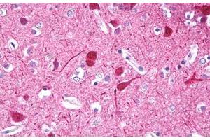 Anti-HMX3 antibody IHC of human brain, cortex neurons.