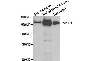 Western blot analysis of extracts of various cell lines, using MYH1 antibody. (MYH1 anticorps)