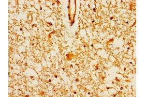 Immunohistochemistry of paraffin-embedded human brain tissue using ABIN7159356 at dilution of 1:100 (MAGI2 anticorps  (AA 1308-1455))