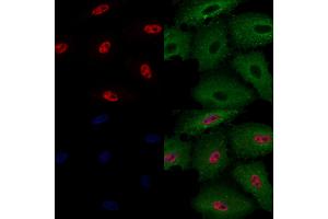 ABIN6260075 and ABIN6272255 staining  cells by IF/ICC. (ASF1B anticorps  (Internal Region))