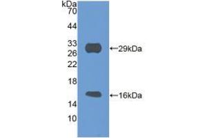 Western blot analysis of recombinant Mouse SIRT3. (SIRT3 anticorps  (AA 5-257))